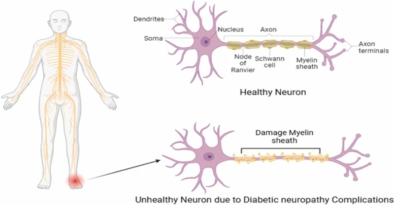 Benfotiamine benefits Benfotiamine benefits
